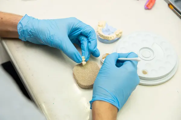A dental technician placing a ceramic crown on a model